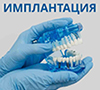 Протезирование